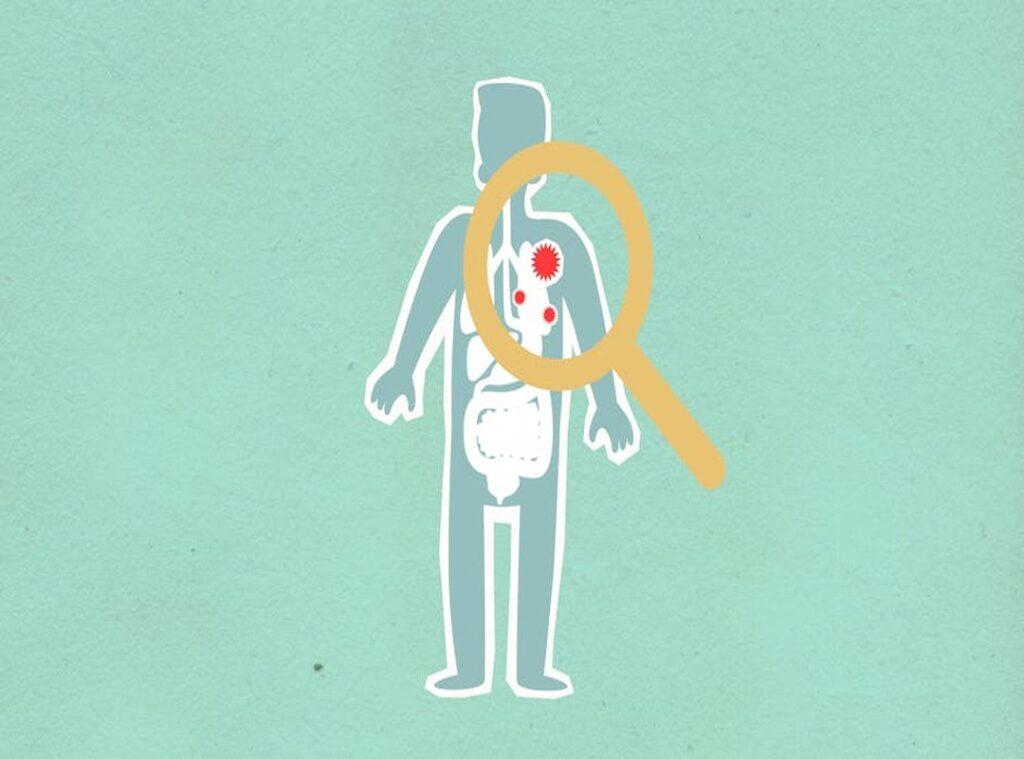 Gasteromaradical Disease in Korea